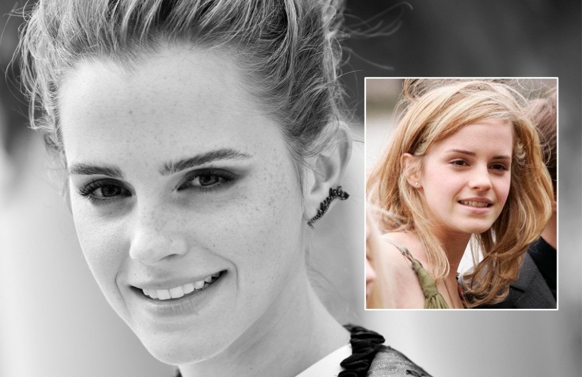 La Emma Resa Famosa Della Saga Di Harry Potter